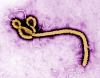 ​У госпитализированного приморца не обнаружено вируса лихорадки Эбола