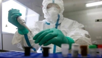 ​Битва с лихорадкой Эбола: российские вакцины проходят испытания